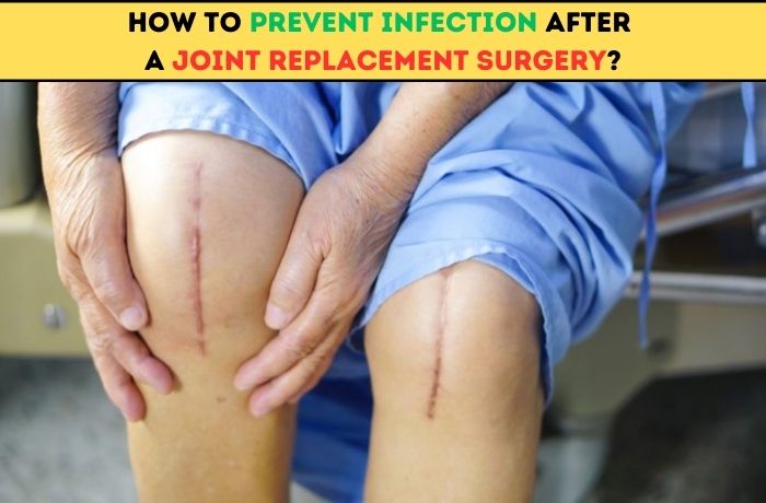 How to Prevent Infection after a Joint Replacement Surgery?