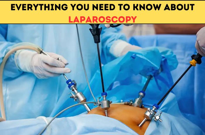 Everything You Need To Know About Laparoscopy