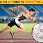 Tips for Athletes to Avoid Fractures: A Complete Guide