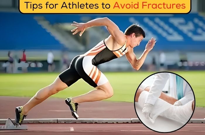 Tips for Athletes to Avoid Fractures: A Complete Guide