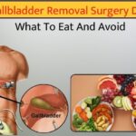 Gallbladder Removal Surgery Diet: What To Eat And Avoid