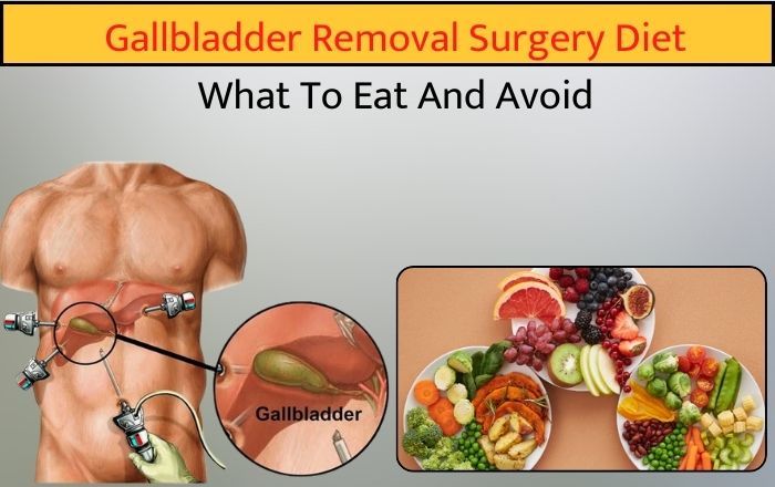 Gallbladder Removal Surgery Diet: What To Eat And Avoid