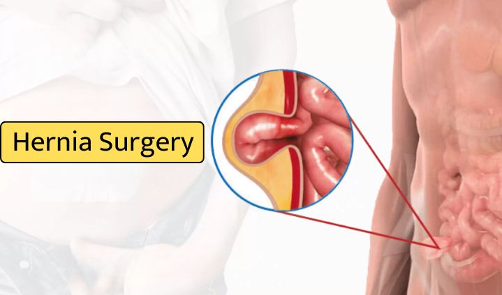 Hernia Surgery/Surgeon in undri | Hernia Treatment in undri